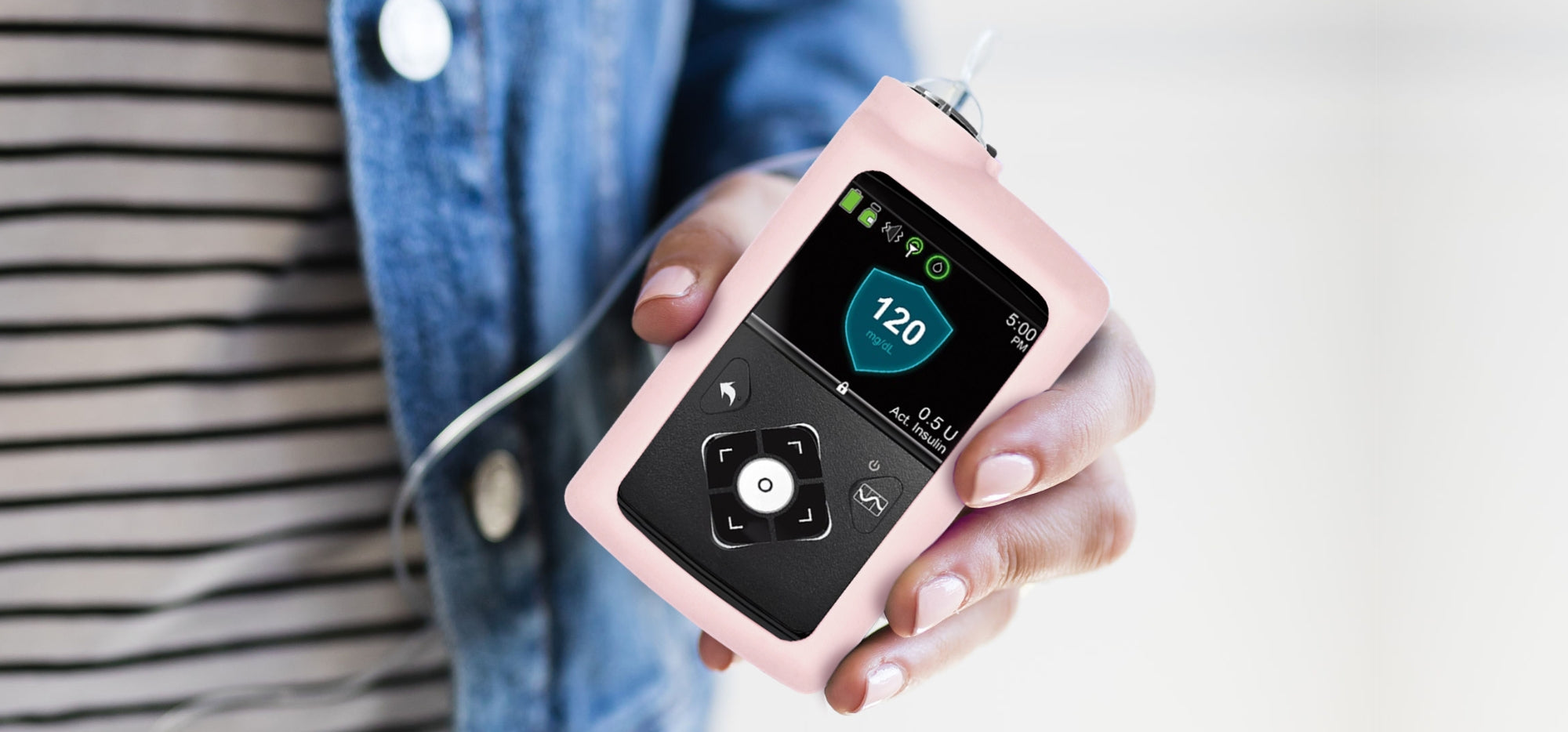 A woman in stripe top holding a Medtronic insulin pump with an aqua Medtronic Silicone Gel Protective Cover on it.