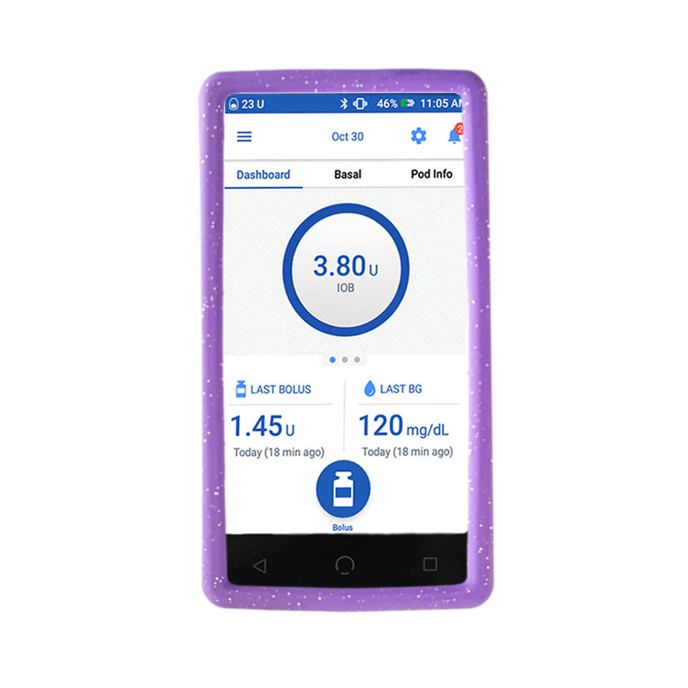 Omnipod Dash with a purple glitter gel skin on it.
