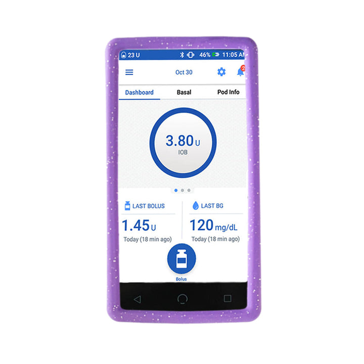 Omnipod Dash with a purple glitter gel skin on it.