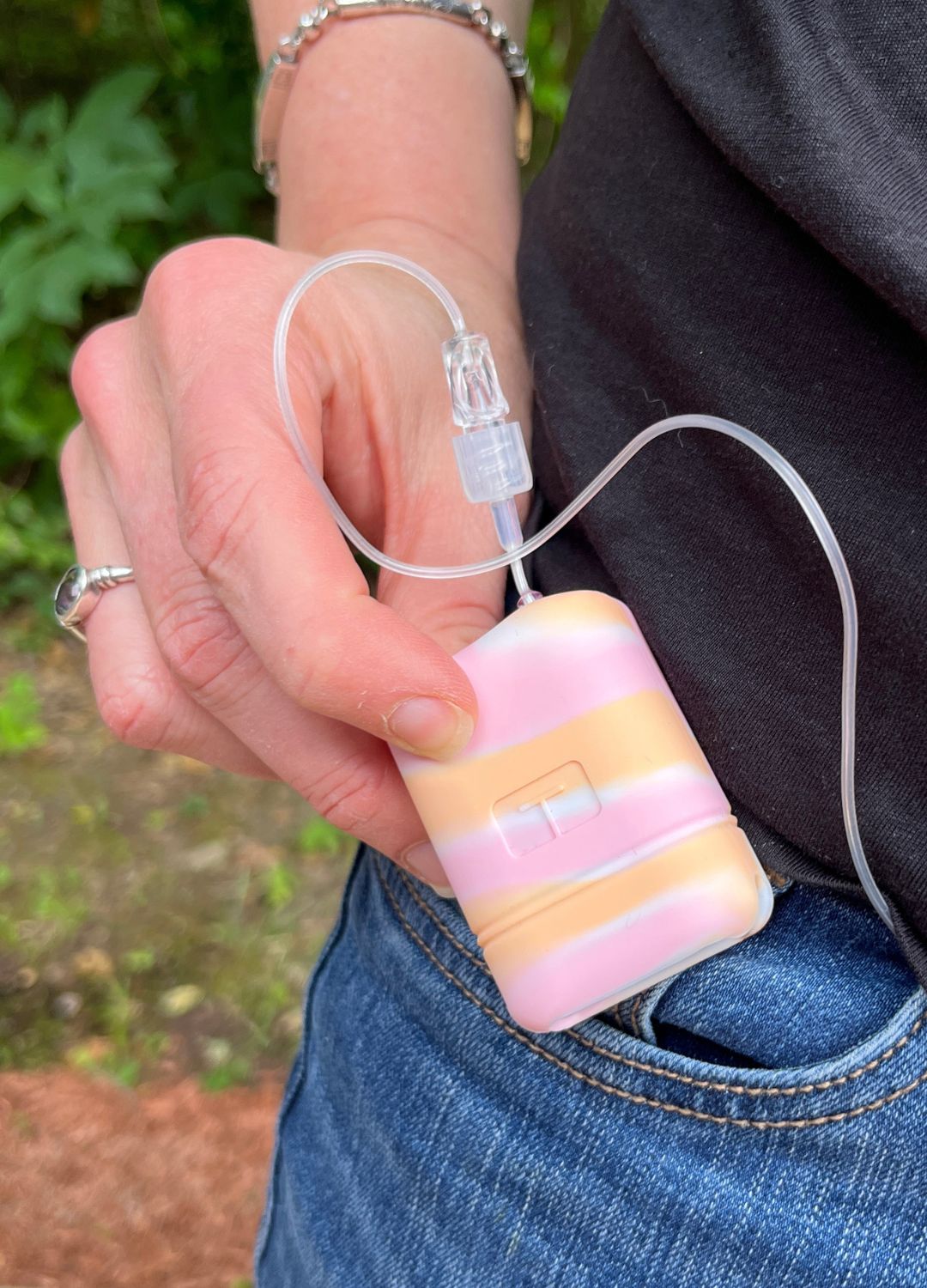 Women holding the Tandem Mobi Insulin pump with a pink, orange and white tie dye silicone protective case on it.