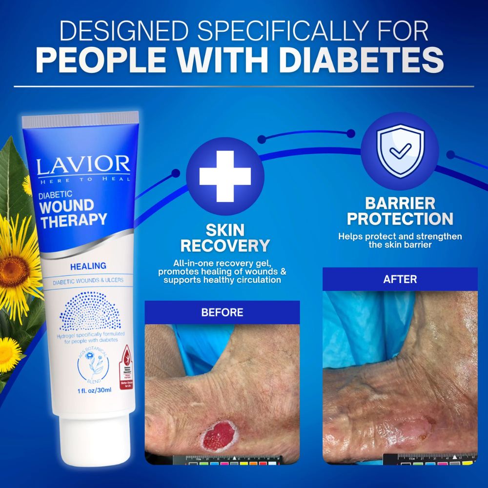 Lavior diabetic wound therapy product with before and after images on a blue background