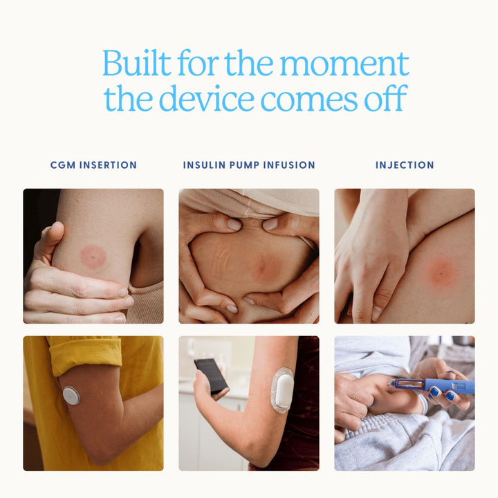 Collage of insulin administration methods with text 'Built for the moment the device comes off'.