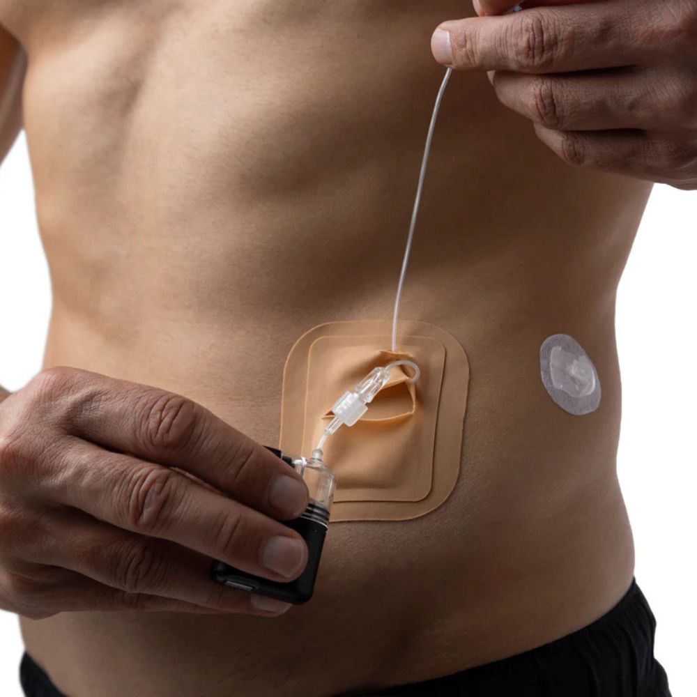 Tan Skin Grip adhesive patch measuring approximately 4 x 3 inches, shown securing a Tandem Mobi insulin pump on the side of a person's abdomen for a discreet, skin-tight fit.