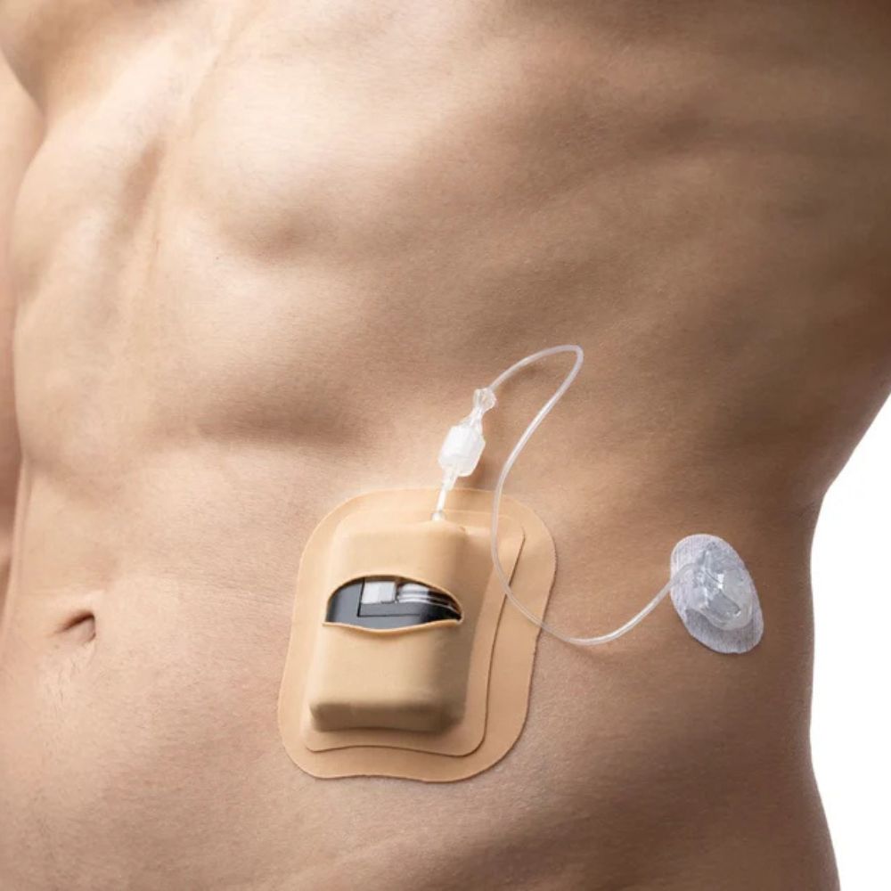 Tan Skin Grip adhesive patch shown applied over a Tandem Mobi insulin pump, providing secure and comfortable skin attachment.