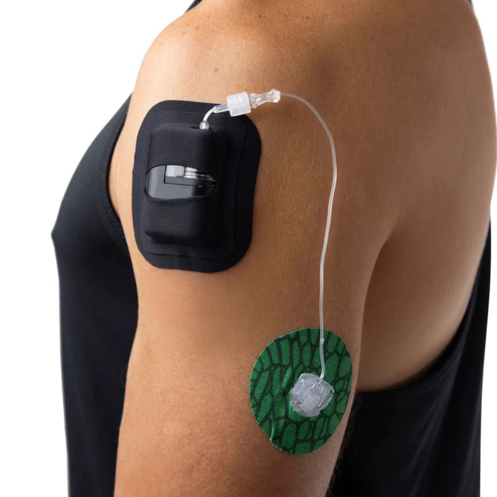 Black Skin Grip adhesive patch shown applied over a Tandem Mobi insulin pump, providing secure and comfortable skin attachment.