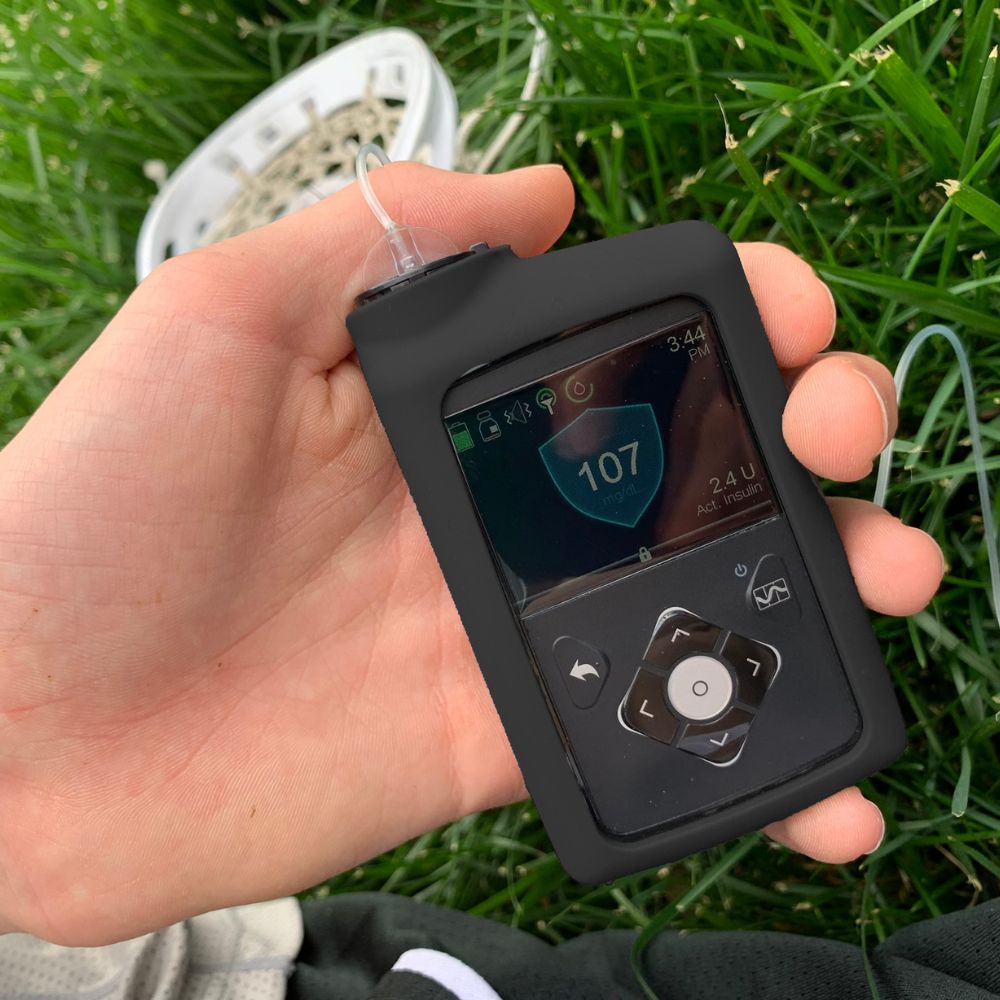 A boy holding Black Medtronic Insulin Pump Gel Skin with Medtronic pump in it. 