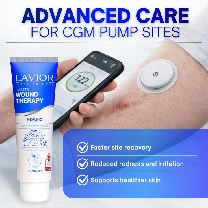 Lavior diabetic wound therapy with CGM pump and smartphone app on a white background