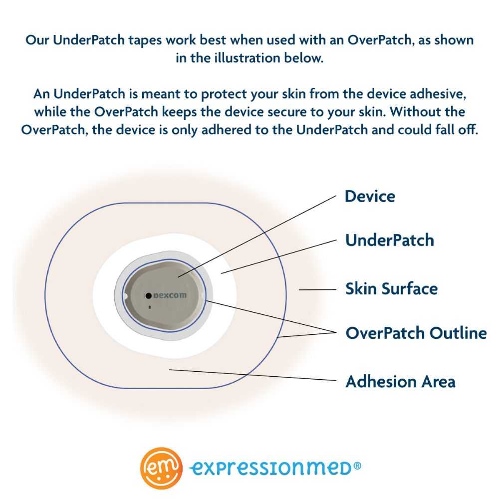 Diagram of Dexcom UnderPatch tapes that work best when used with an OverPatch. 