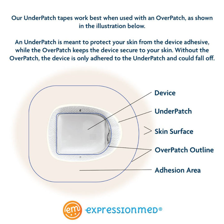 Diagram on an Expression Med Omnipod Underpatch showing the device, underpatch, skin surface, OverPatch outline and adhesion area. 